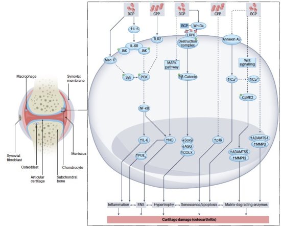 Image Latest publication linking pathologic calcification with osteoarthritis