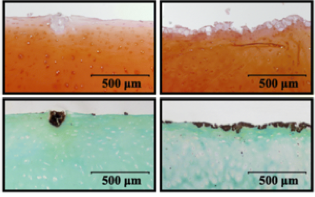 von Kossa staining showing dark brown deposits of calcium on cartilage surface (lower panels) 